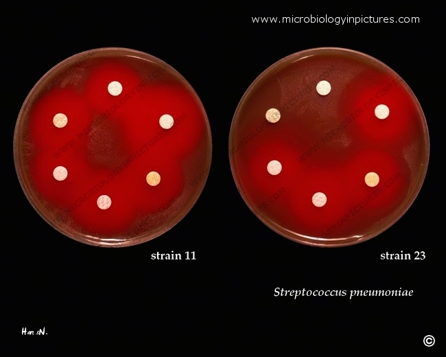 streptococcus-pneumoniae-antibiotic